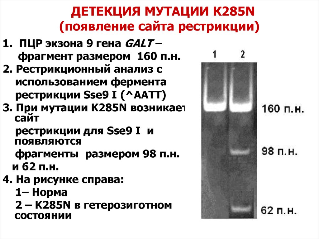 Детекция это. Прямая детекция мутантных генов. Мутации в гене Galt. Детекция мутаций в гене. Рестрикционный анализ мутации.