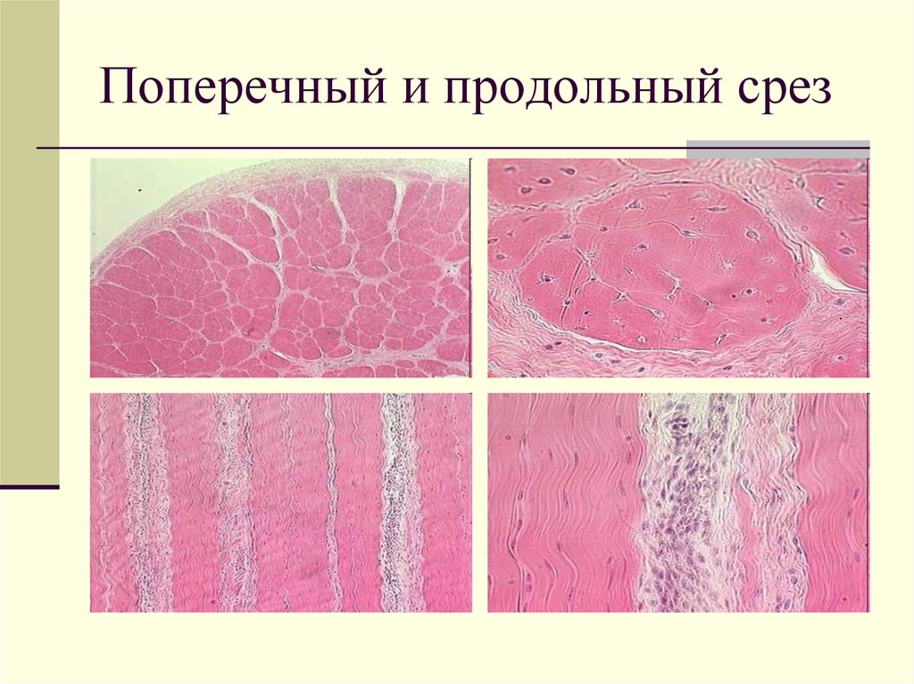 Продольный срез. Поперечный и продольный срез. Поперечный срез и продольный срез.