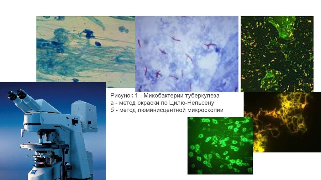 Микобактерии микроскопия. Микобактерии туберкулеза люминесцентная микроскопия. Микобактерии туберкулеза микроскопия. Люминесцентная микроскопия туберкулеза. Люминесцентная микроскопия МБТ.