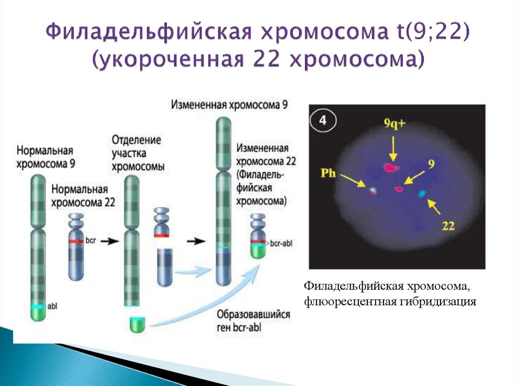 Филадельфийская коляска акт что это. Филадельфийская хромосома транслокация. Синдром филадельфийской хромосомы. Филадельфийская хромосома при хроническом миелолейкозе. Филадельыиская хромомсп.