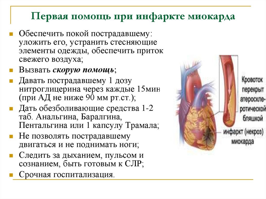 Инфаркт миокарда первая помощь. Оказание первой помощи при инфаркте. 1 Медицинская помощь при остром инфаркт миокарда. Оказание неотложной медицинской помощи при инфаркте миокарда. Оказание 1 помощи при инфаркте миокарда.