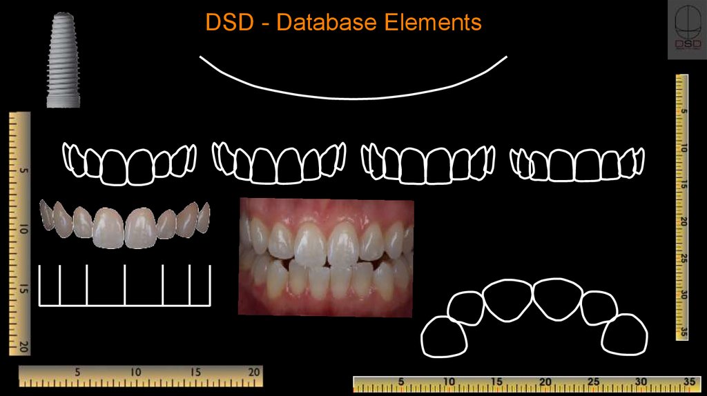 DSD, Digital Smile Design - online presentation