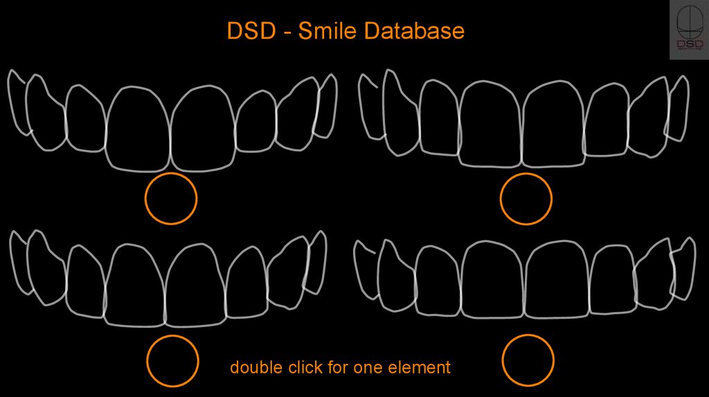 Dsd Digital Smile Design Online Presentation