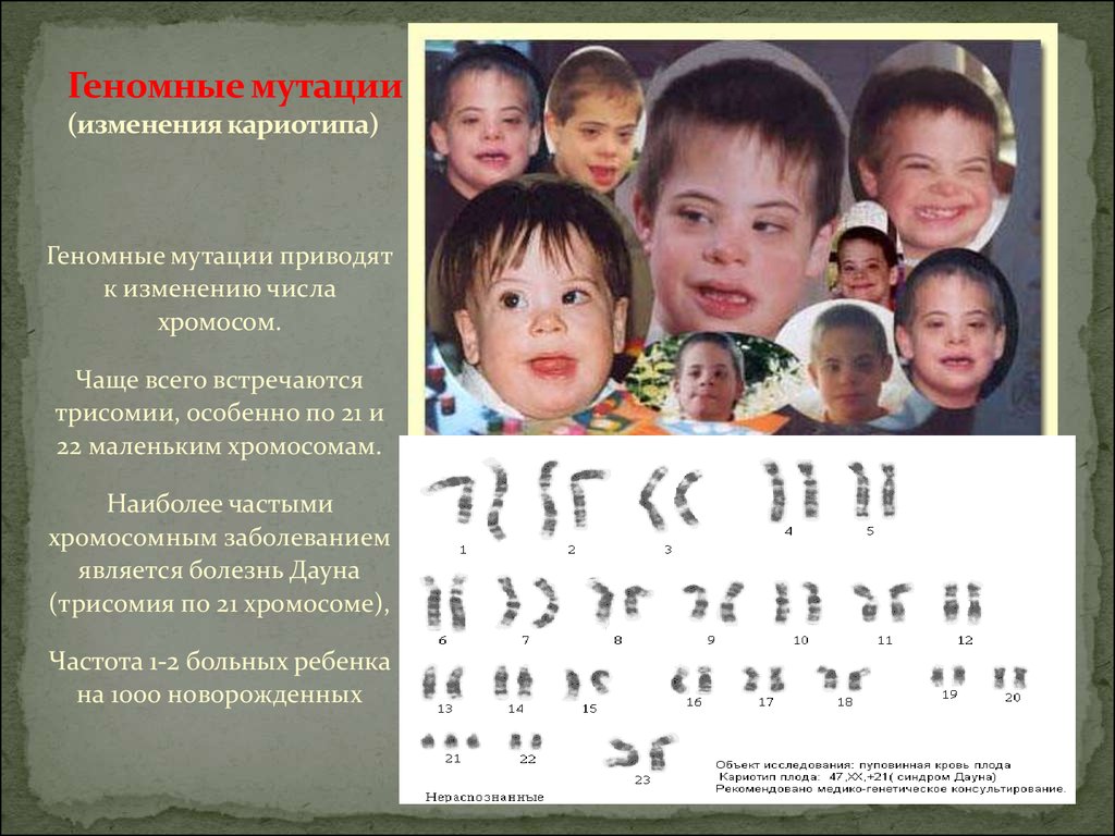 Изменение количества хромосом мутация. Геномные мутации примеры. Геномные мутации кариотип. Пример геннотипной мутации.