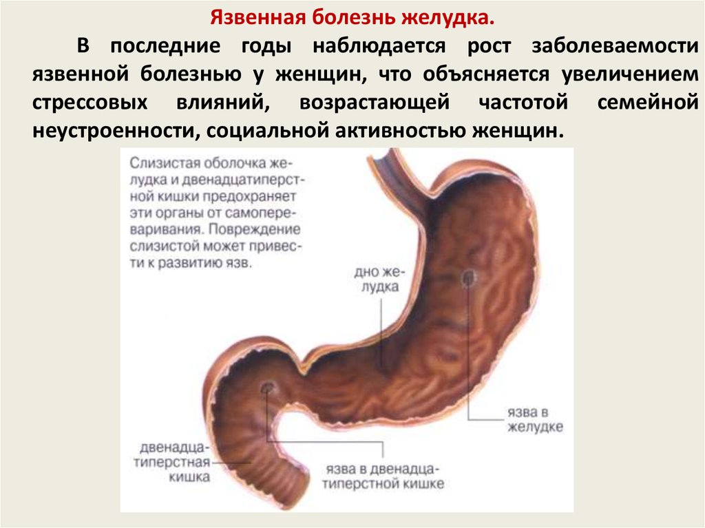 Сообщение о заболевании пищеварительной системы