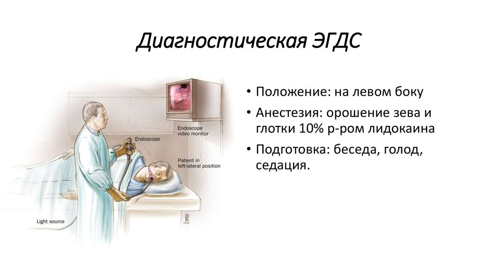 Диагностическая ЭГДС