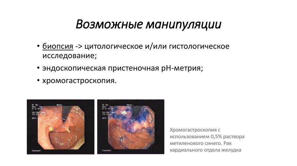 Возможные манипуляции