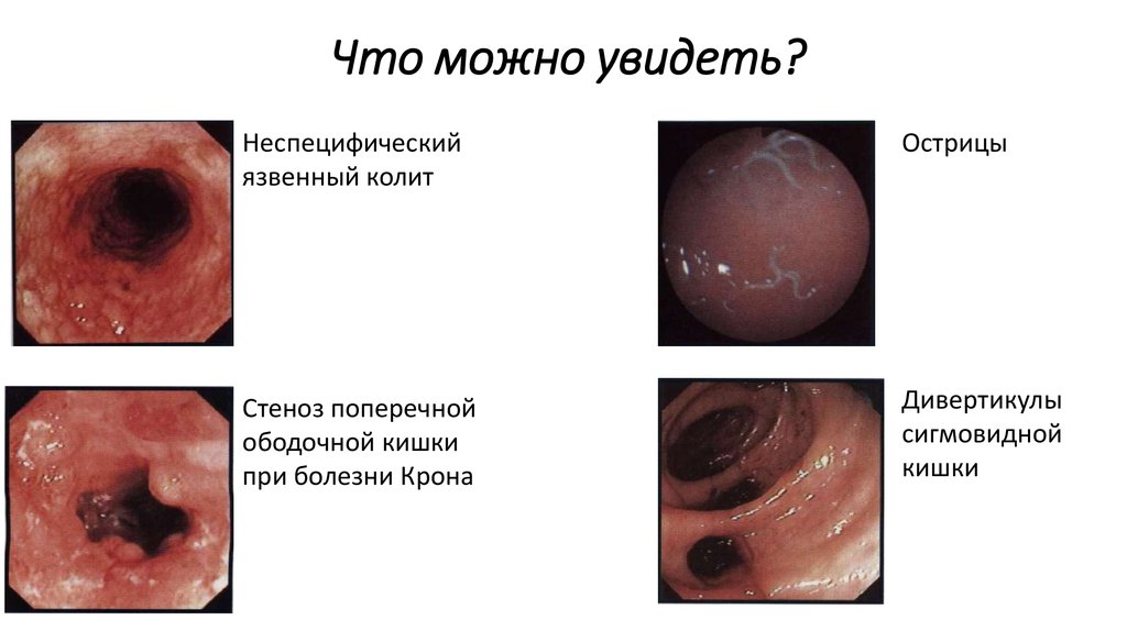 Что можно увидеть?