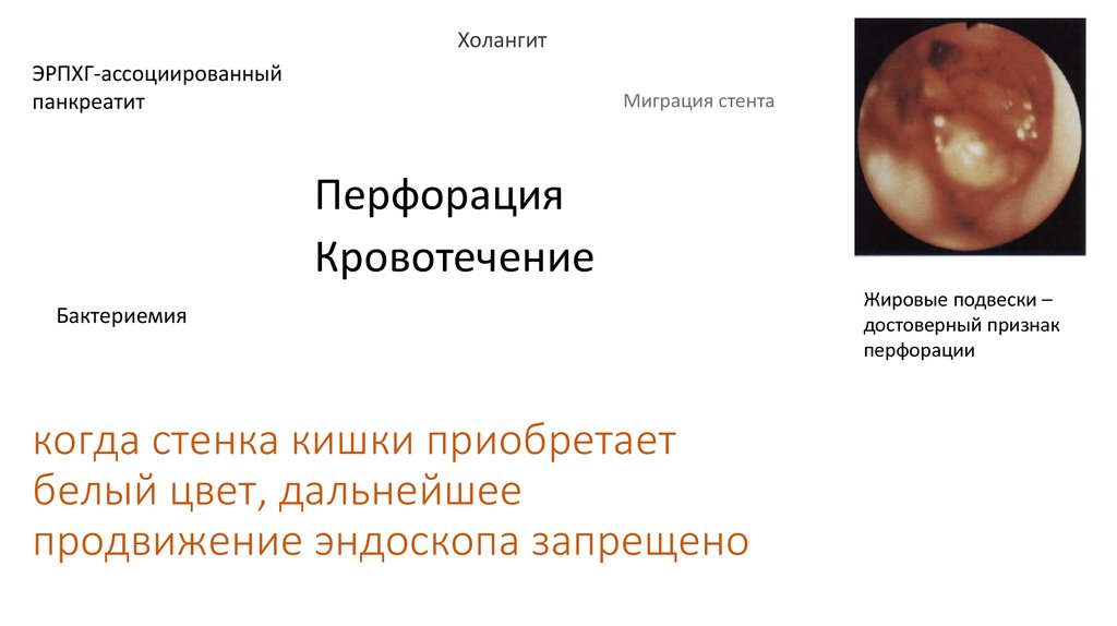 когда стенка кишки приобретает белый цвет, дальнейшее продвижение эндоскопа запрещено