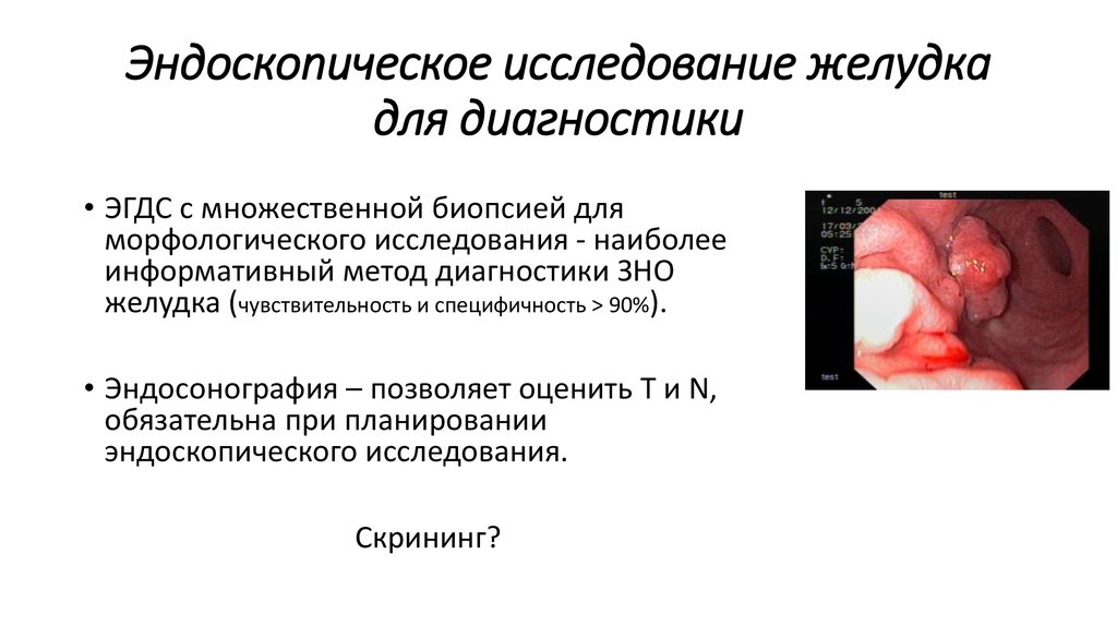 Эндоскопическое исследование желудка для диагностики