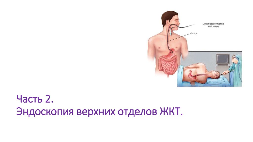 Часть 2. Эндоскопия верхних отделов ЖКТ.