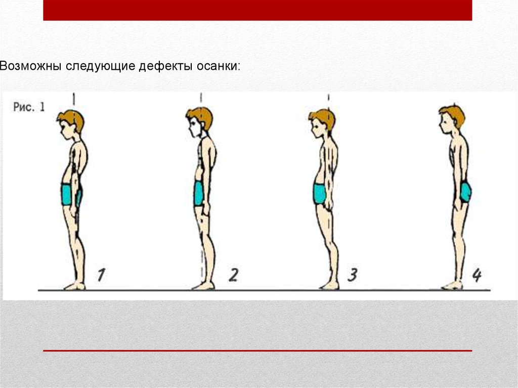 Стена осанки. Осанка упражнения для осанки. Дефекты осанки. Силовые упражнения для осанки. Правильной осанки дефекты.