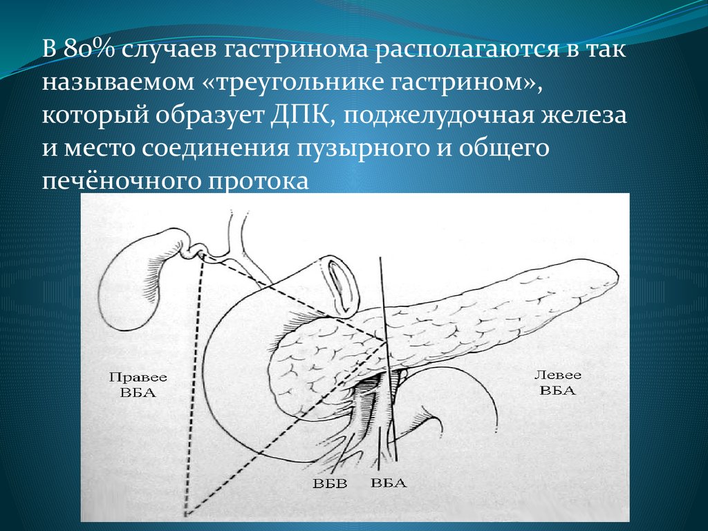 Синдром золлингера эллисона что это такое симптомы