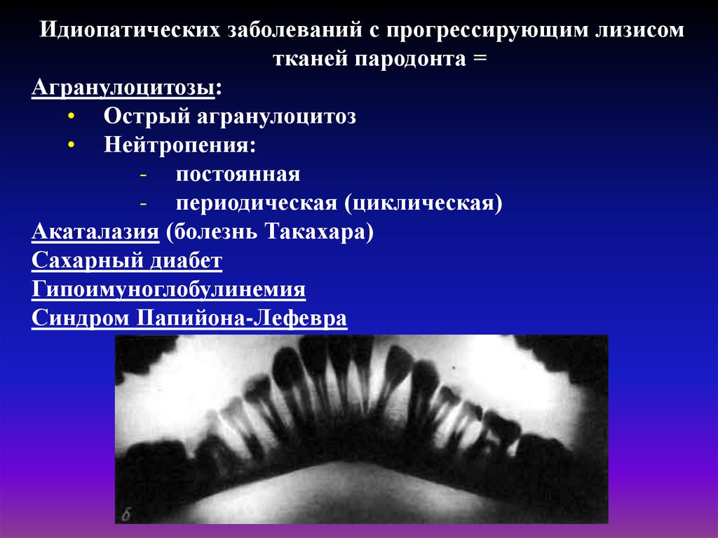 Идиопатические заболевания пародонта презентация