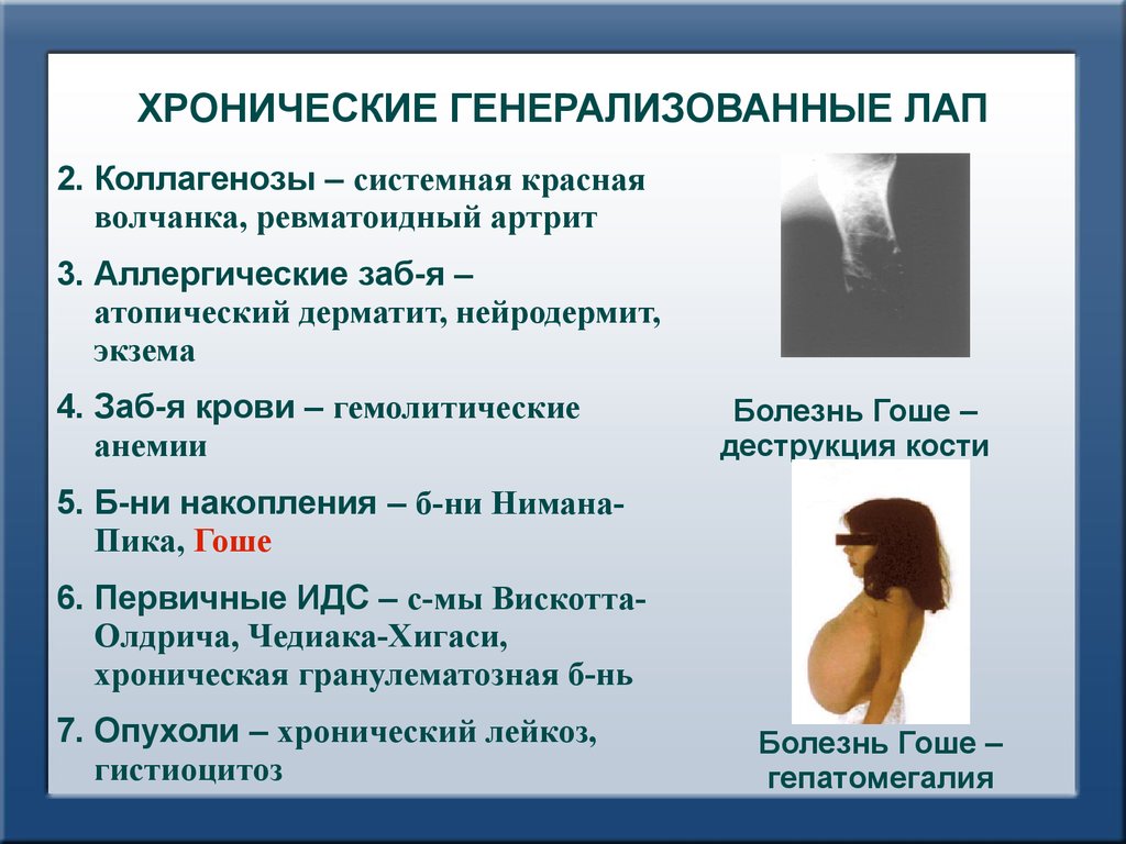 Красная волчанка ревматоидный артрит