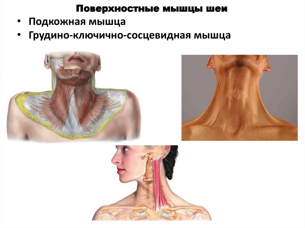 Миозит шеи карта вызова