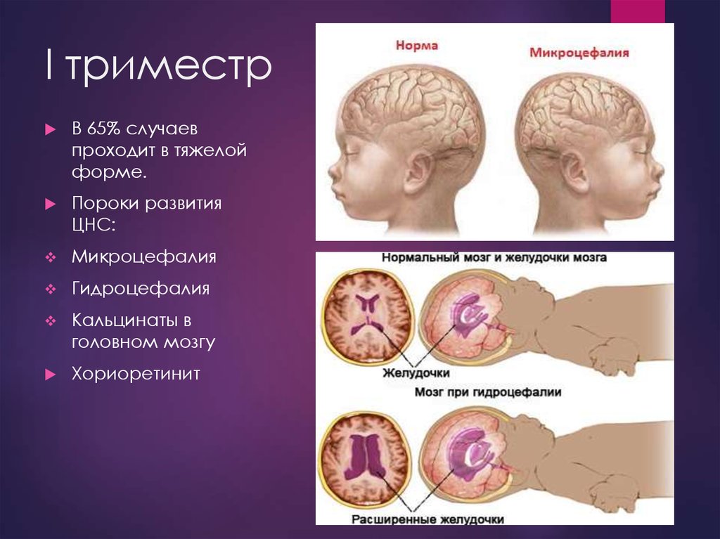 Низкая плацентация при беременности 2 триместр лечение отзывы врачей