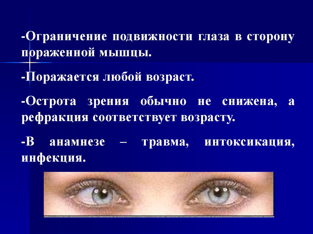 Ограничение подвижности. Косоглазие презентация. Ограничение подвижности глаз. Ограничение подвижности глазного яблока. Бинокулярное зрение и косоглазие.