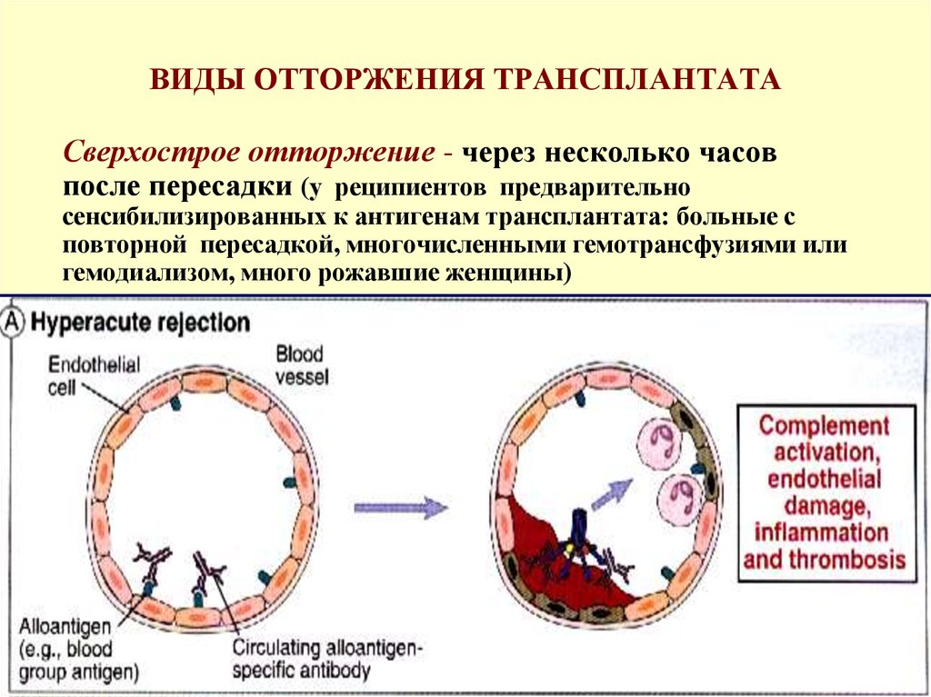 Трансплантационный иммунитет иммунология презентация