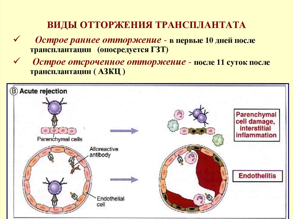 Трансплантационный иммунитет иммунология презентация