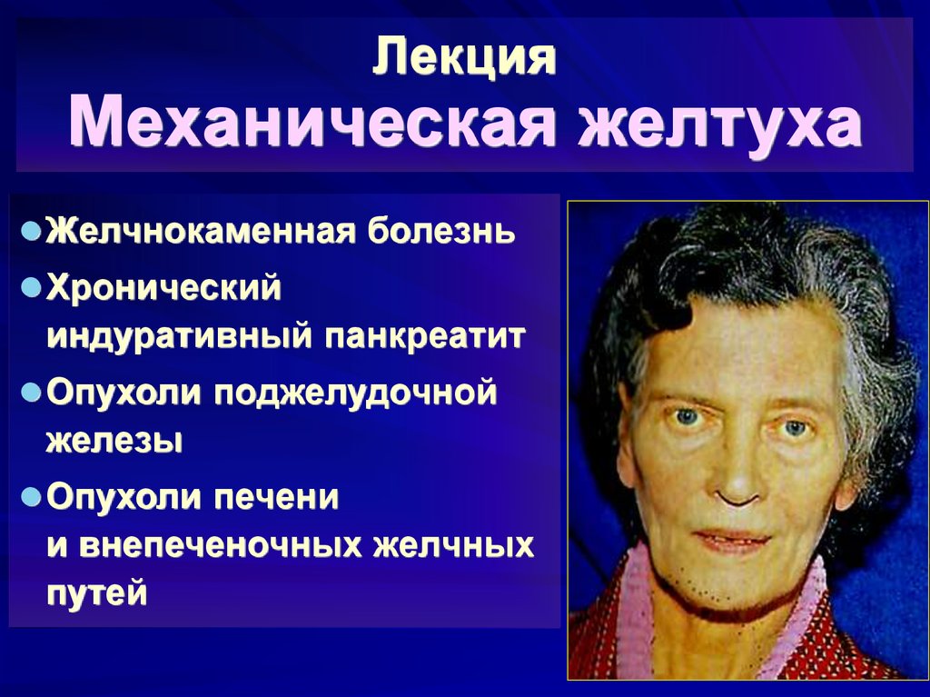 Болезнь лекция. Механическая желтуха. Механическая желтуха симптомы. При механической желтухе наблюдается. Клинические проявления механической желтухи.