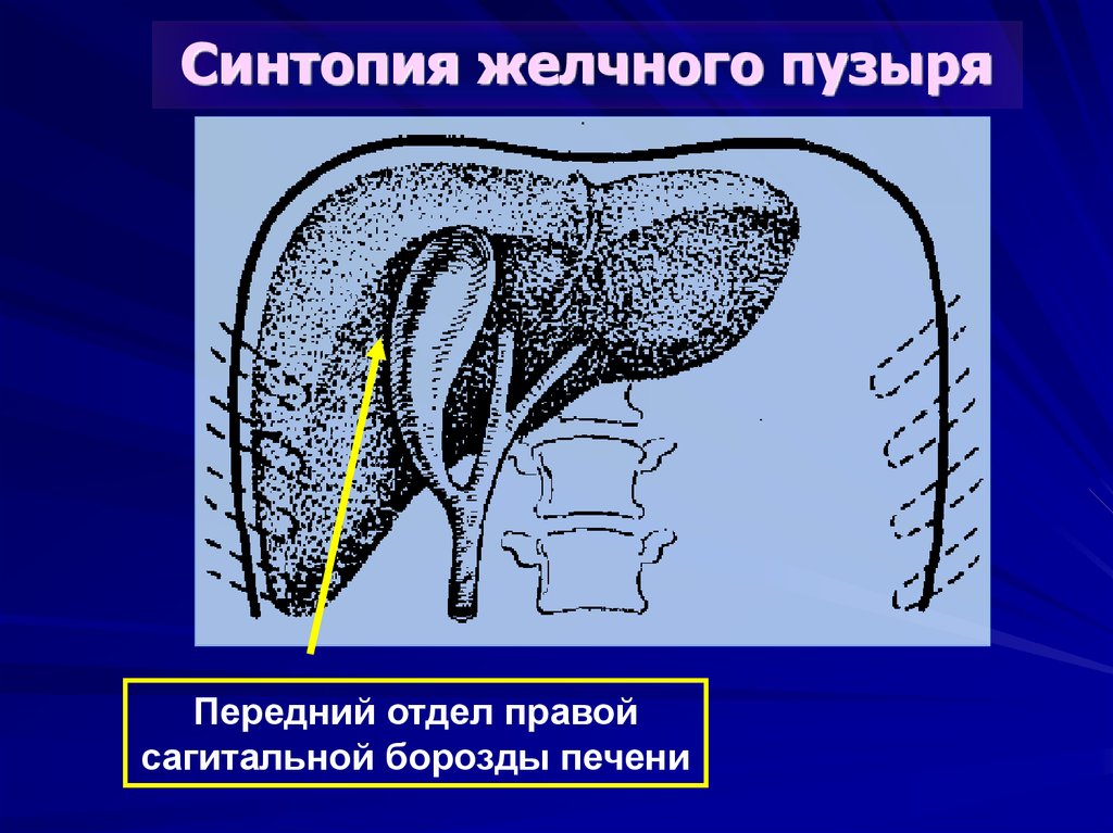 Механическая желтуха карта смп