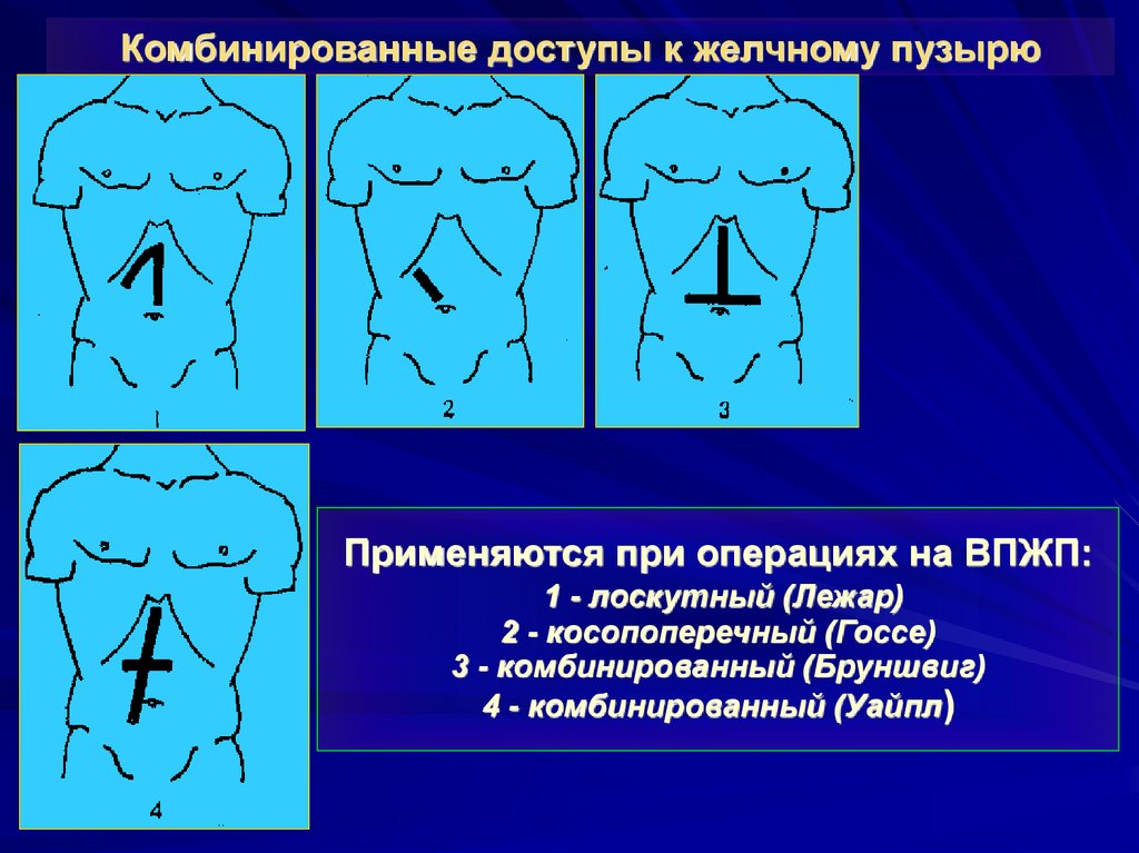 Хирургия механическая желтуха презентация