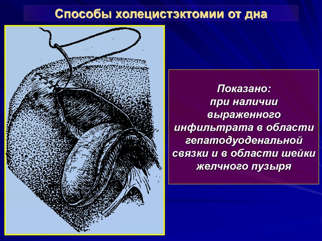 Хирургия механическая желтуха презентация