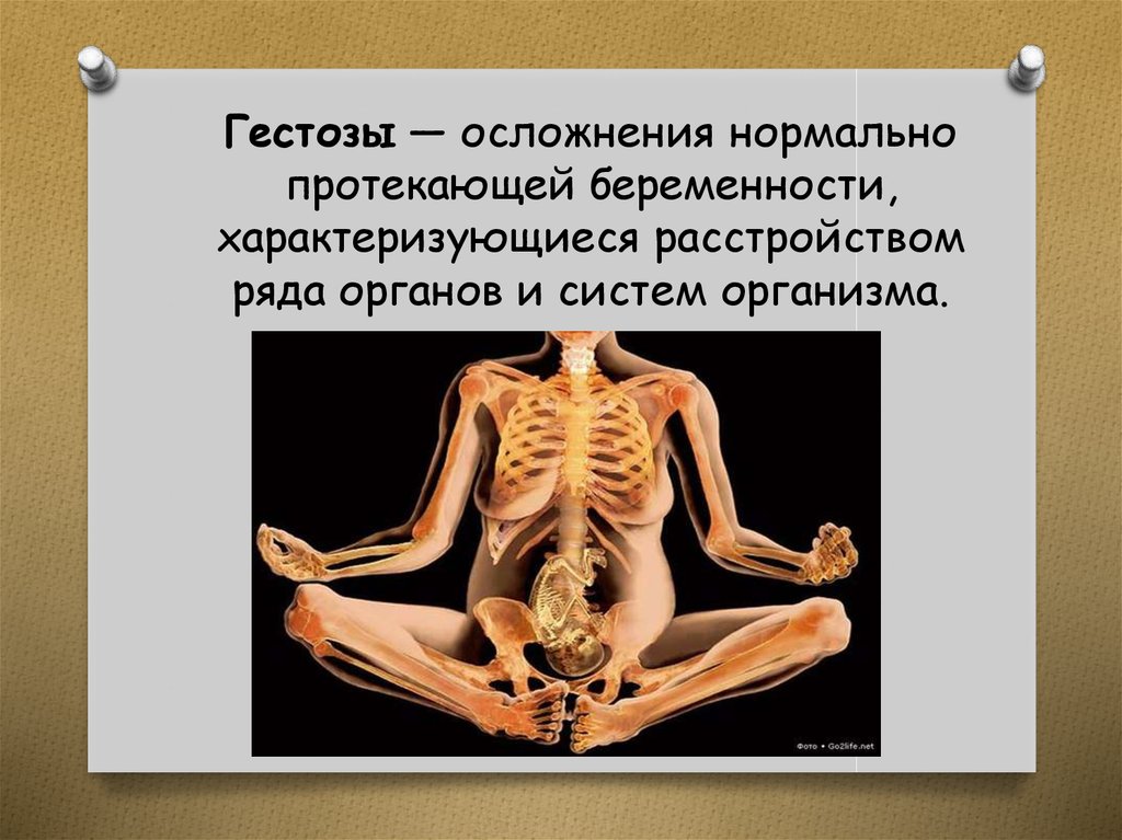 Гестозы — осложнения нормально протекающей беременности, характеризующиеся расстройством ряда органов и систем организма.