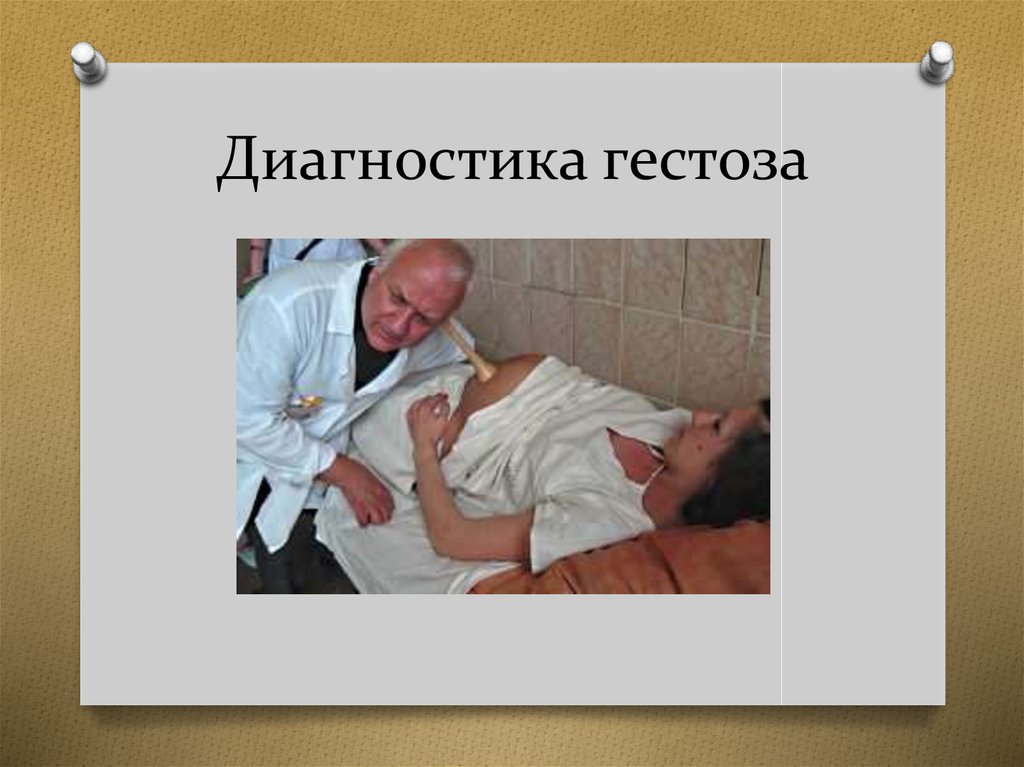 Диагностика гестоза