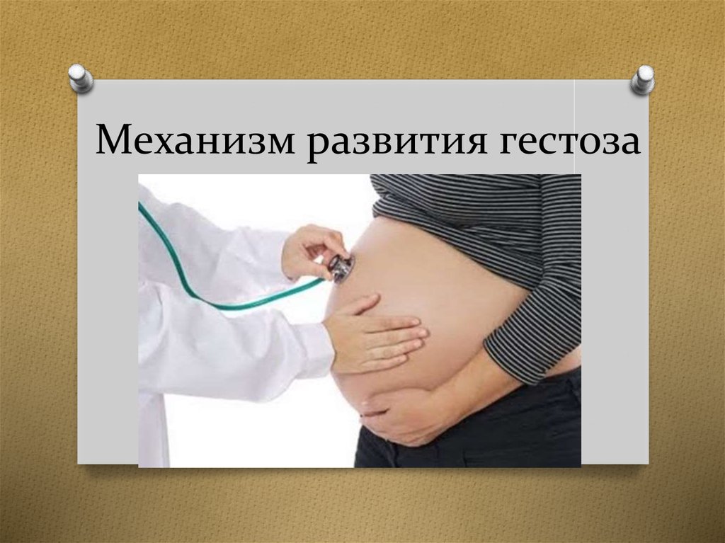 Поздние гестозы презентация