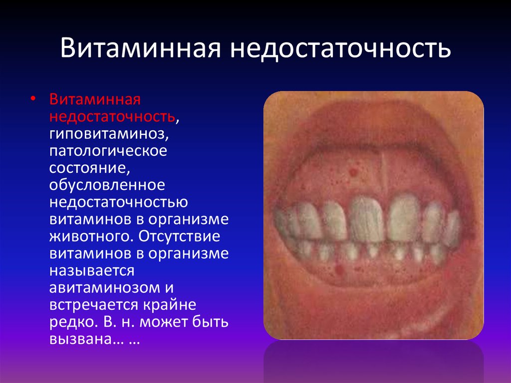 Витаминная недостаточность