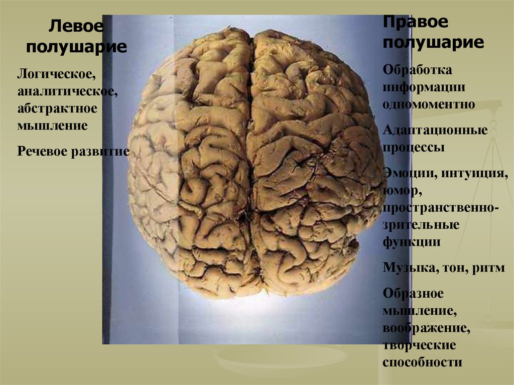 Человеческий мозг полушария. Левое полушарие. Мышление левое и правое полушарие.