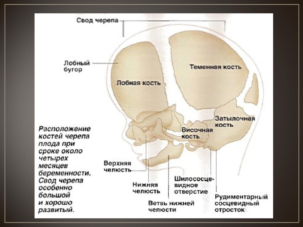 Соединение лобной и теменной кости