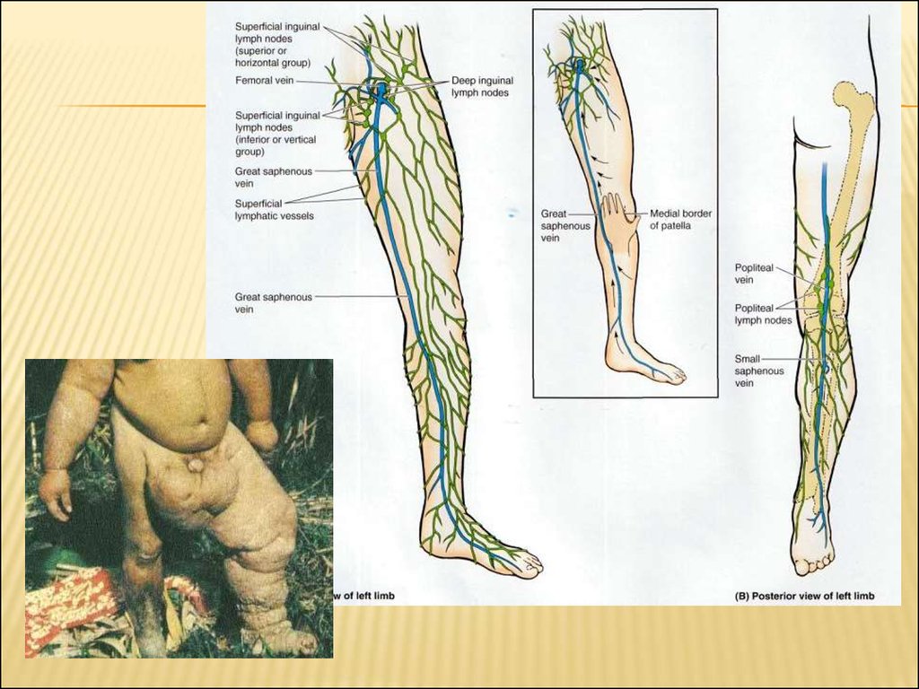 Нервы ноги. Анатомия нервов нижних конечностей схема. Нервные окончания нижних конечностей. Нервы нижней конечности анатомия схема. Лимфоузлы нижних конечностей.