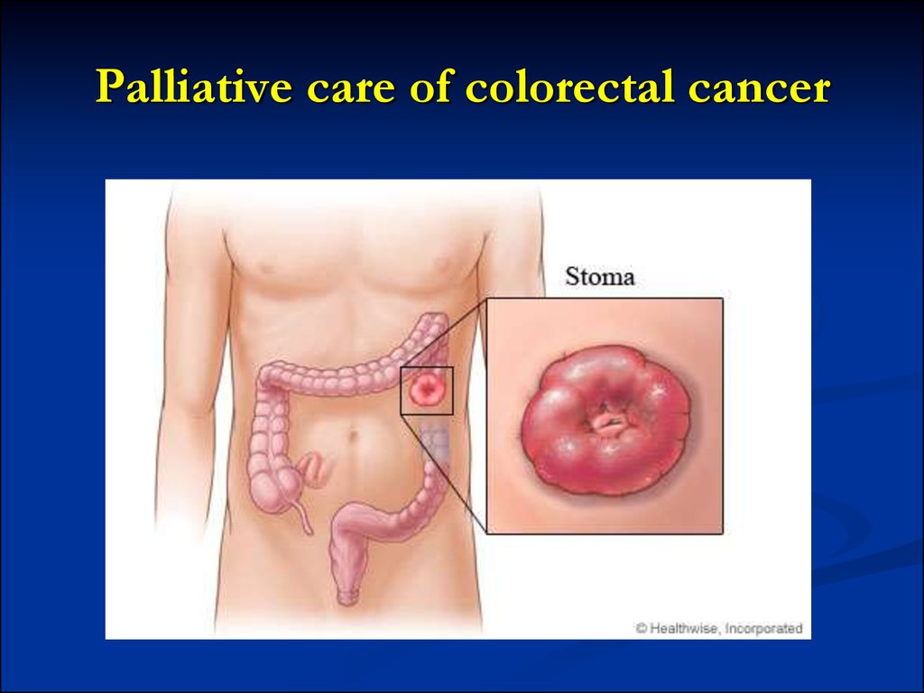 Palliative care of colorectal cancer