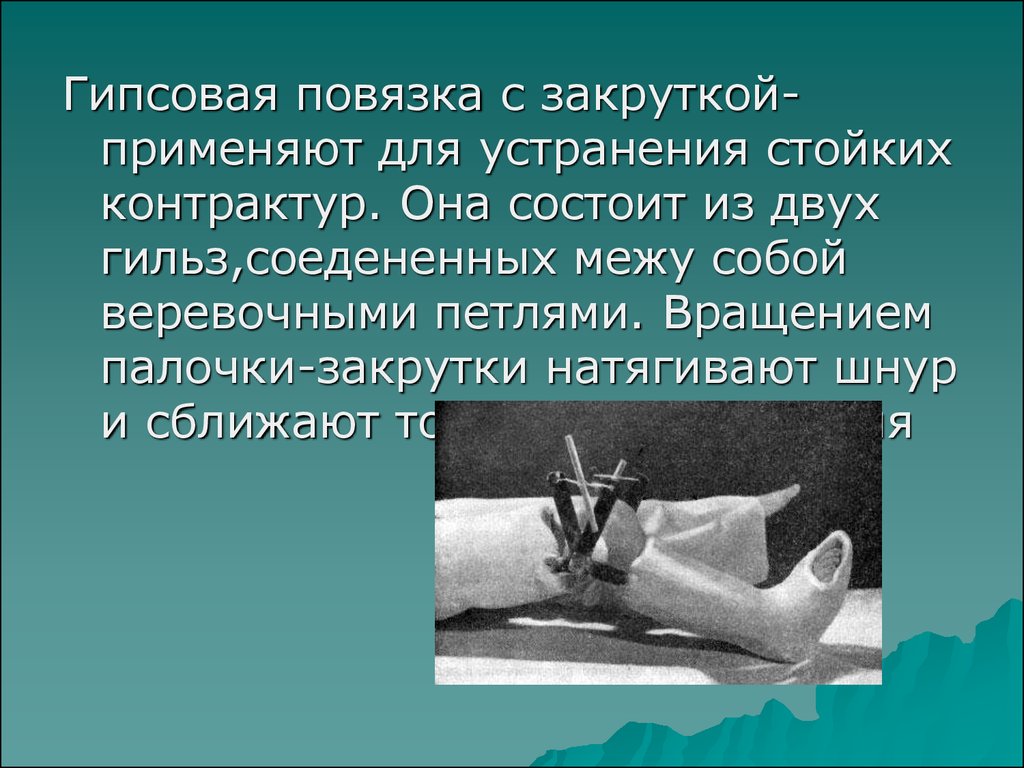 Применение гипсовой повязки ученый. Гипсовая повязка с закруткой. Гипс презентация. Гипсовые повязки применяются для. Шарнирная гипсовая повязка.