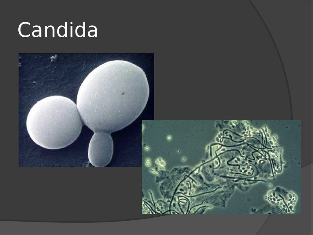 Дрожжеподобные грибы candida. Candida albicans морфология. Дрожжеподобные грибы рода Candida. Строение грибов рода Candida albicans. Грибы Candida морфология.