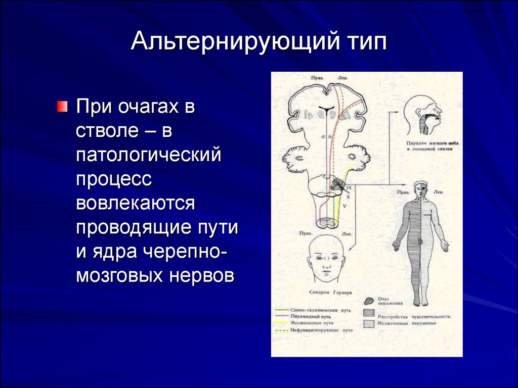 В формировании клинической картины синдрома джексона участвует черепной нерв