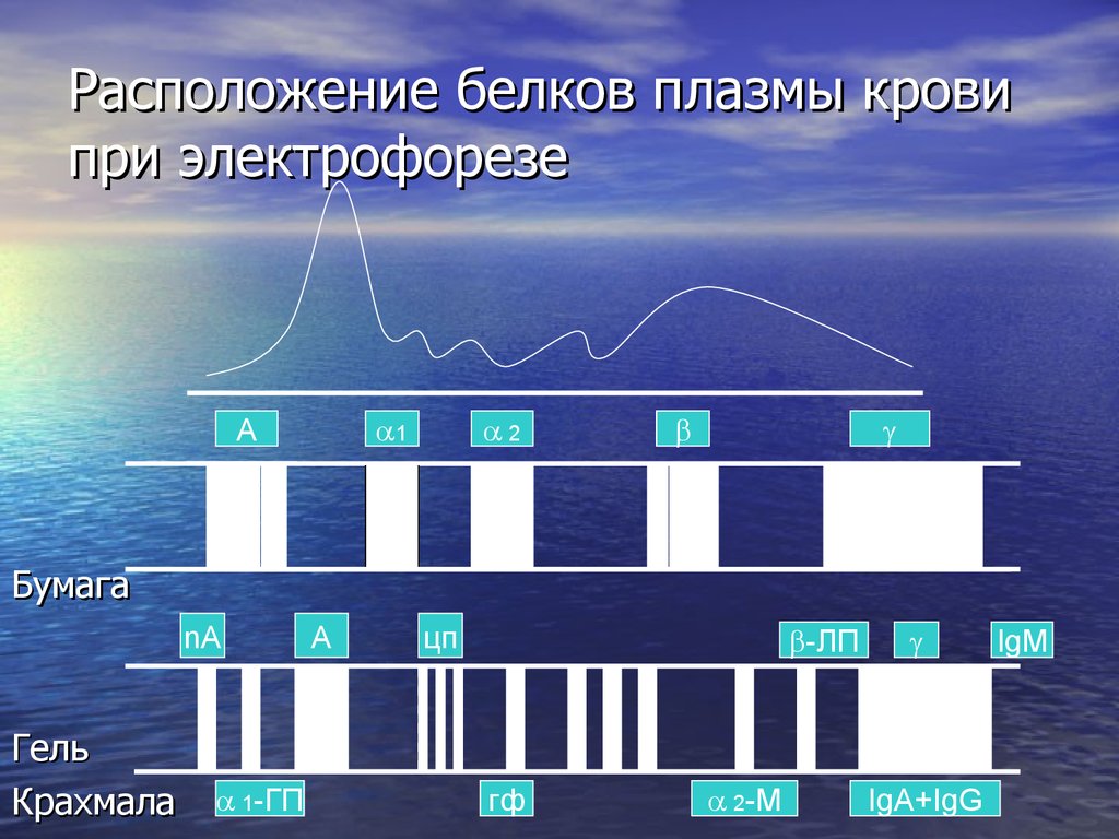 Расположение белков. Электрофореграмма белков плазмы крови. Электрофорез белков плазмы крови. Электрофорез белков плазмы. Электрофоретические фракции белков плазмы крови.