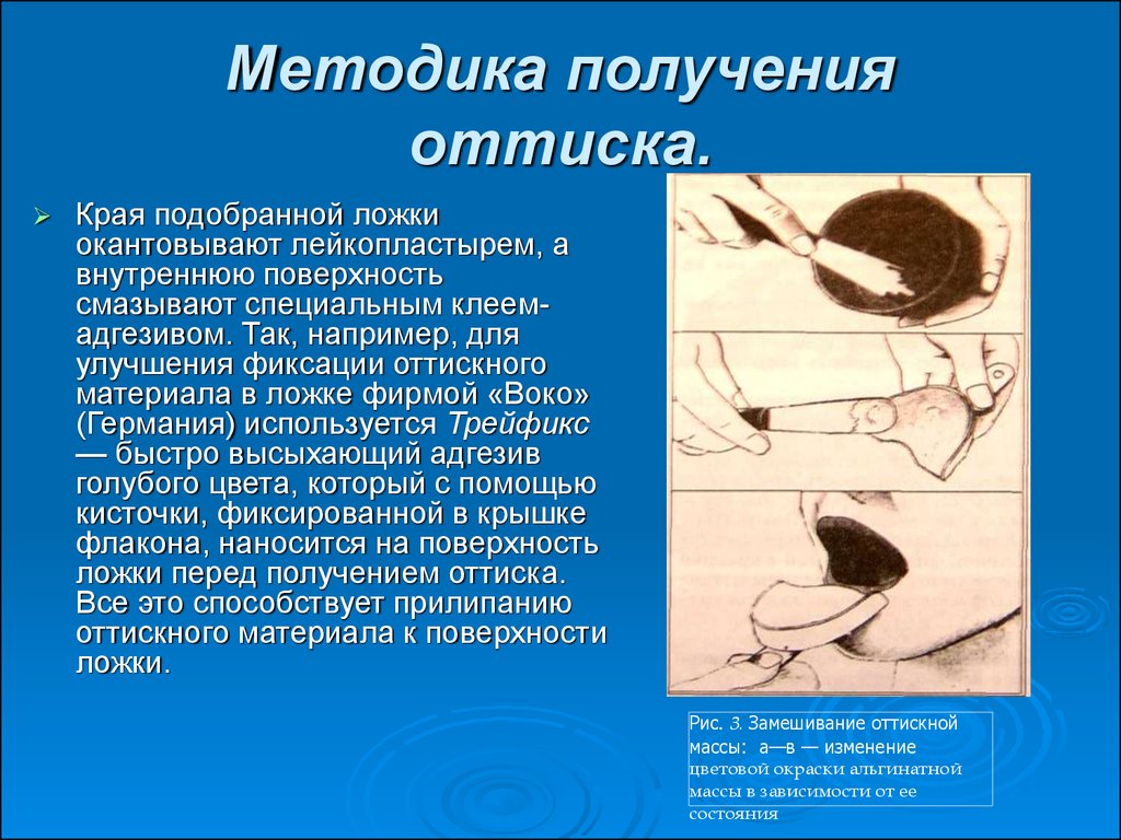 План обработки слепочной ложки