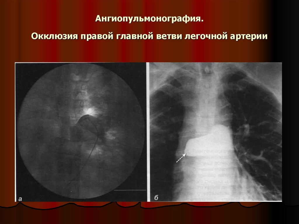 Большая кровопотеря пострадавший в сознании картинка