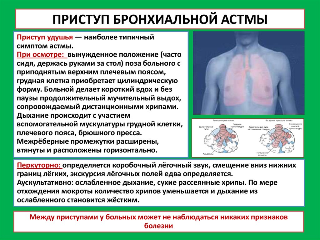 Больно дышать слева. Тип грудной клетки при бронхиальной астме. Приступ бронхиальной астмы симптомы. Приступ удушья при бронхиальной астме. Приступ удушья при бронхиальной астме симптомы.