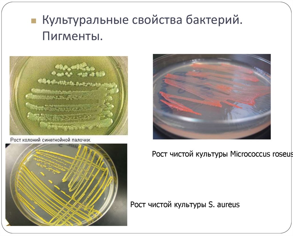 Культуральные свойства бактерий. Пигменты.