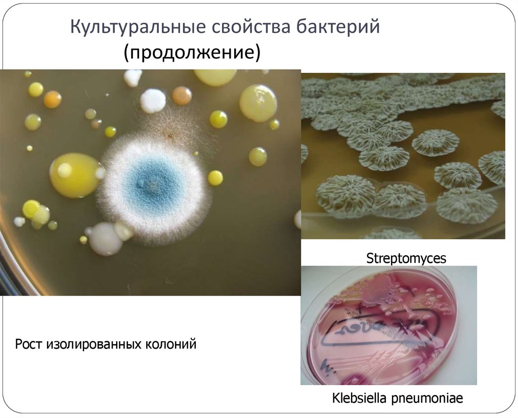 Схема описания колоний бактерий