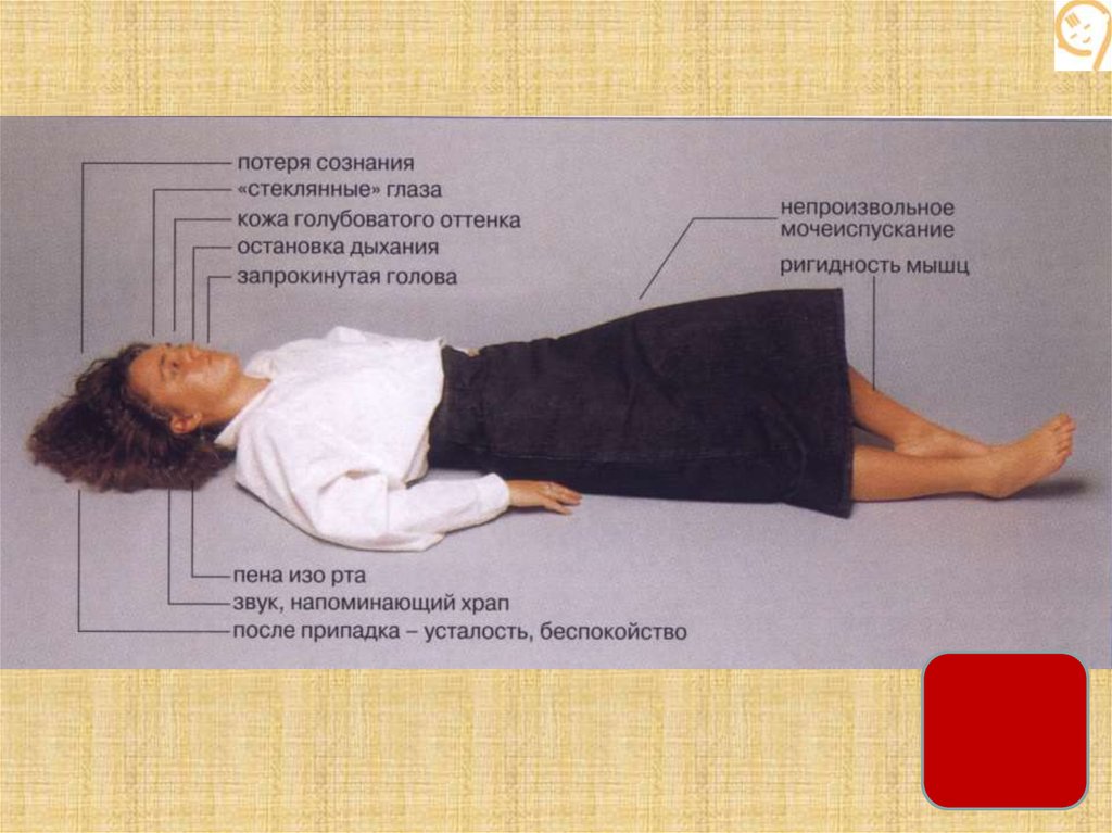 Эпилепсия. Этиология - презентация онлайн