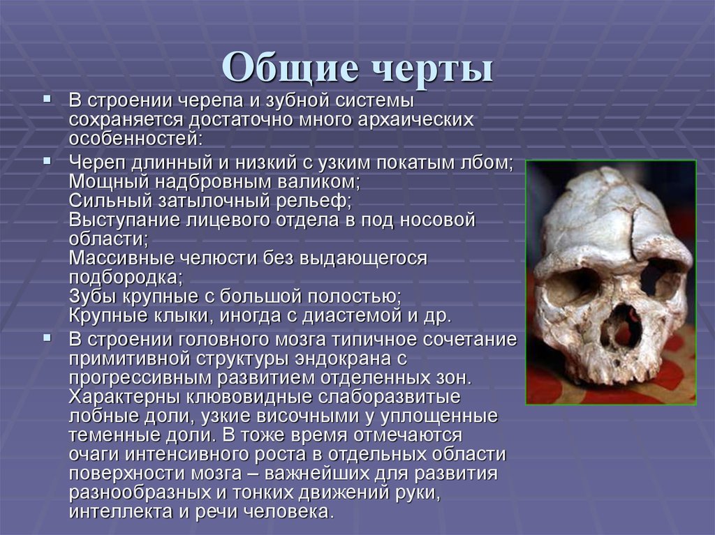 Общие черты