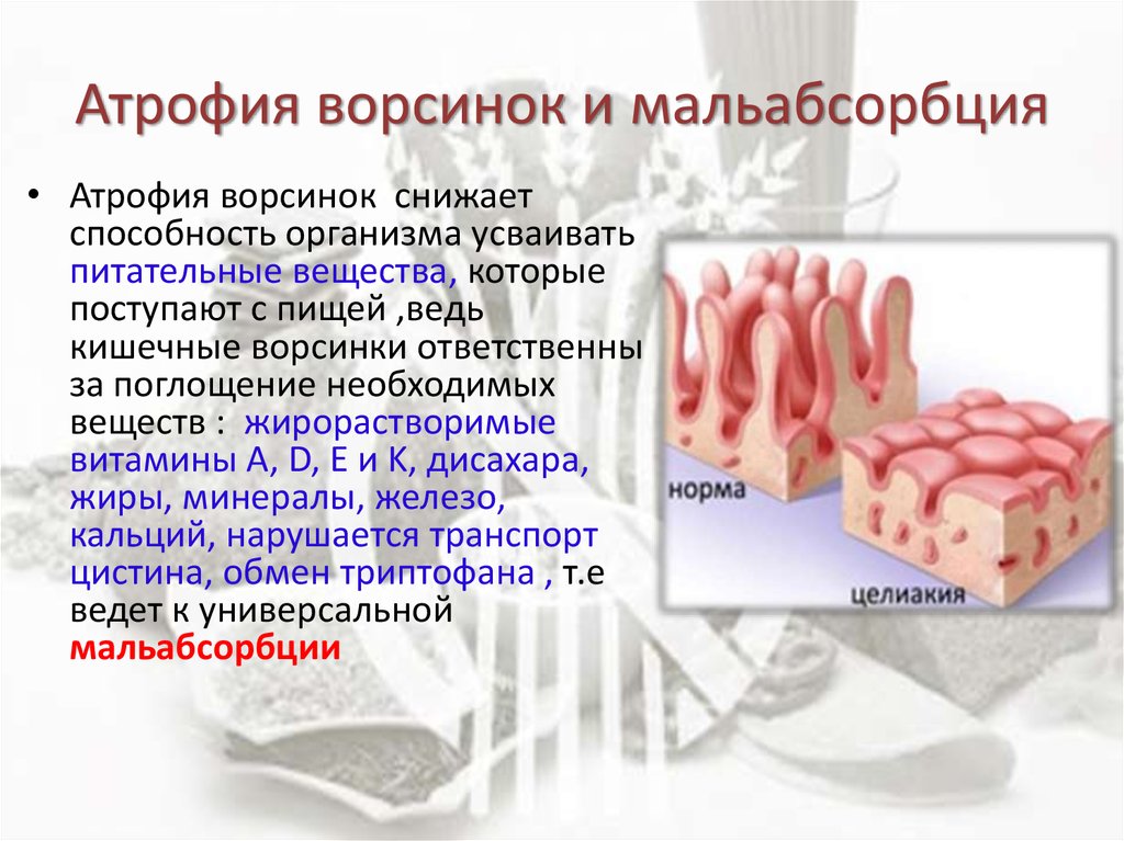 Атрофия презентация патология