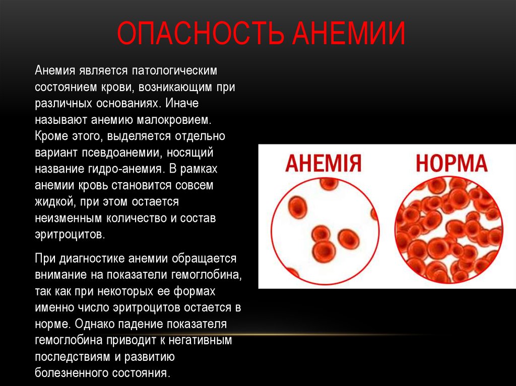 Причины анемии крови. Заболевания при анемии. Малокровие болезнь крови.