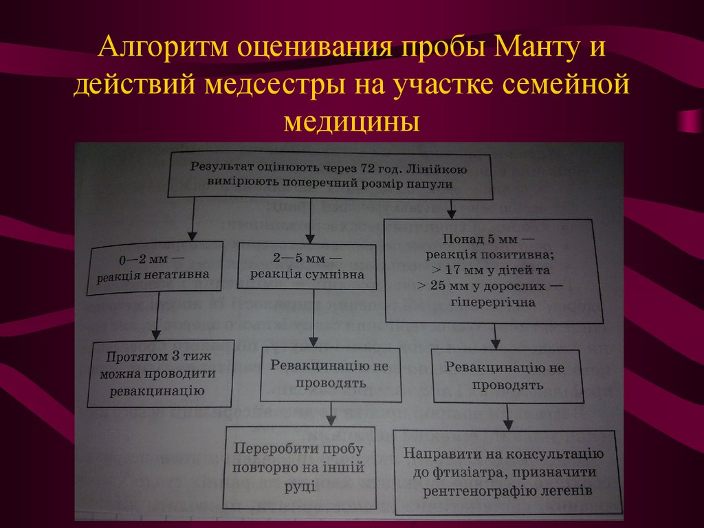 Алгоритм действий медсестры. Проведение и оценка пробы манту алгоритм. Постановка пробы манту алгоритм проведения. Постановка пробы манту алгоритм.